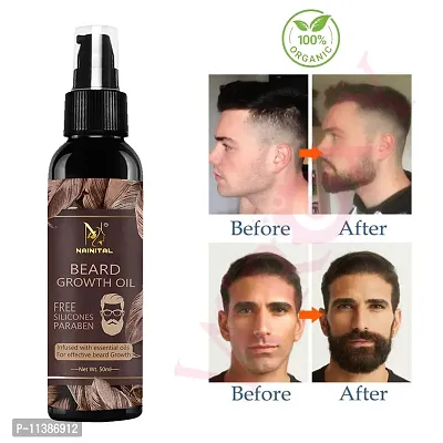 Nainital Extra Advanced Beard Oil For Men Fast Beard Growth Oil Almond-Jojoba Hair Oil -50 ml-thumb0