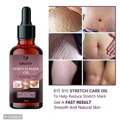 Ayurvedic Body Massage Bio Oil For Stretch Marks, Oil For Scar Removal, Aging And Wrinkled Skin- 40 ml-thumb0