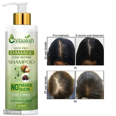 Anti Hairfall Bhringraj Shampoo 200 Ml-thumb0