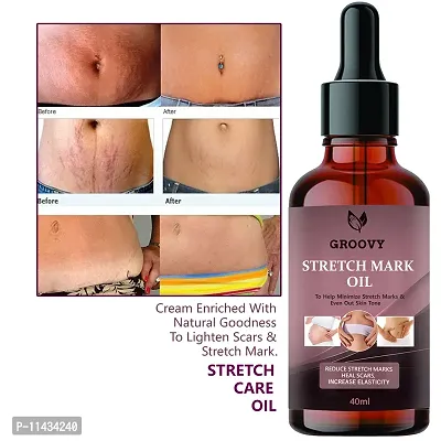 Stretch Mark Oil With The Goodness Of Sea buckthorn Oil, Vitamin E And C, Lavender  All Skin Types  For Scars And Stretch Marks-40 ml-thumb0