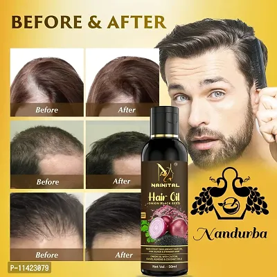 Hair Oil New Hair Growth And Hair Fall Solution -50 Ml For Men And Women-thumb0