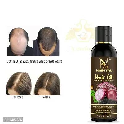 Onion Hair Oil Controls Hairfall And Promotes Growth - Hair Oil 50 Ml For Men And Women-thumb0