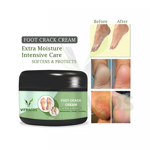 Foot Crack Cream- 50 GramsHealing And Softening Cream