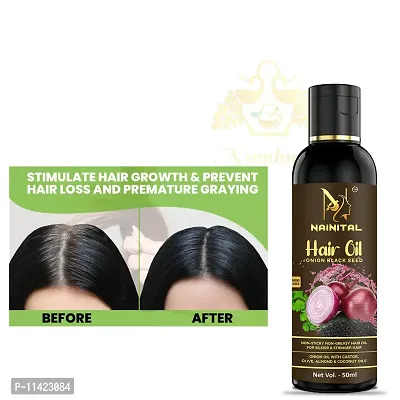 Hair Oil Herbal Hair Oil Blend Of Natural Oils , Dandruff Control And To Stop Hair Fall 50 Ml-thumb0