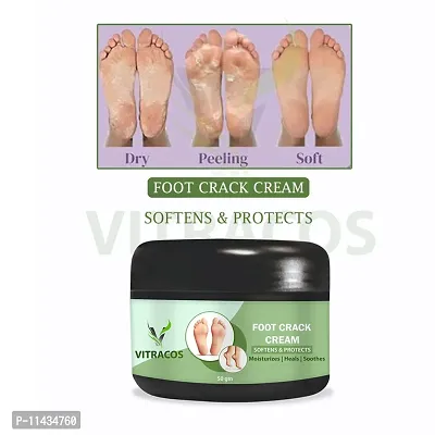 Foot Cream  New Arivals Foot Cream Flavour  For Woman-thumb0