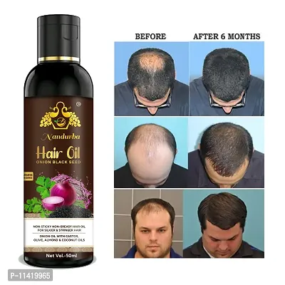 Onion With Black Seed Oil For Controls Hair Fall Hair Oil 50 Ml For Men And Women