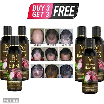 Onion Hair Oil 7 Day Challenge For Hair Growth Buy 3 Get 3 Free-thumb0