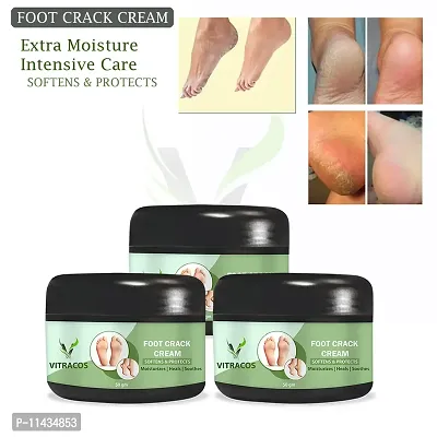 Foot Therapy Cream - 50 G - Moisturization, Nourishing And Softening For Dry And Flaky Skin - Cruelty Free- Pack Of 3, 50 Grams each