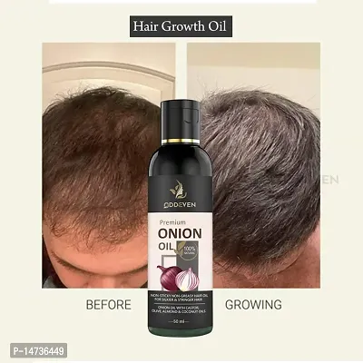 Onion black seed hair oil  ONION HAIR OIL (50ML) (PACK OF 1)-thumb0