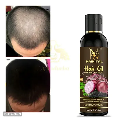 Hair Oil For Hair Growth And Hair Fall Control Glossier Hair For Men And Women-Pack Of 1-thumb0