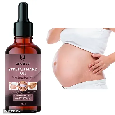 Stretch Marks Oil  Stretch Marks Oil To Reduce Stretch Marks Of Body, Belly, Thighs, Nourishment For Woman  40  ml