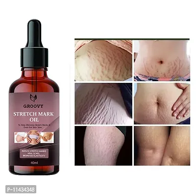 Stretch Marks Oil  Stretch Marks Oil To Reduce Stretch Marks Of Body, Belly, Thighs, Uneven Skin Tone, Firming, Nourishment For Woman  40  ml-thumb0