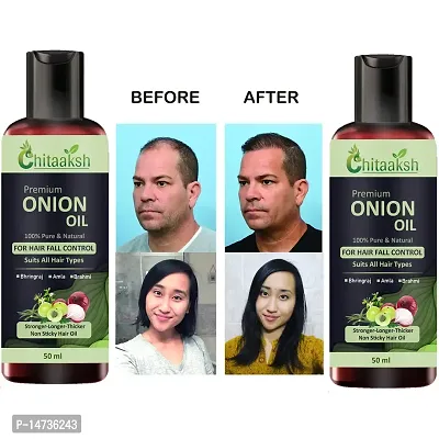 Onion Hair Oil 7 Day Challenge for Hair growth  PACK OF 2-thumb0