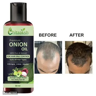 Onion Natural Hair Oil 50 Ml  For Men And Women-thumb0