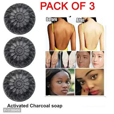 Charcoal Soap For Pimples - Natural Skin Care Soap- 100 Grams Each, Pack Of 3-thumb0