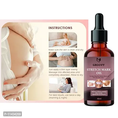 Stretch Marks Oil  Stretch Mark Oil For Moms- 40 ml-thumb0