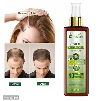 Chitaaksh Natural Onion Hair Oil For Hair Growth With Onion And Redensyl For Hair Fall Control Hair Oil- 100 Ml-thumb0