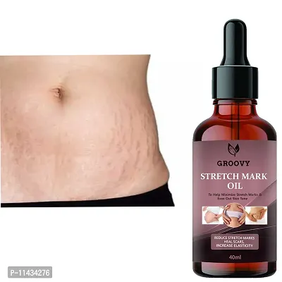 Stretch Marks Oil  Stretch Marks Scar Removal Cream Oil In During After Remover Scars- 40 ml-thumb0