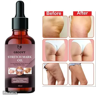 Stretch Marks Oil  Moms Soft And Stretch Oil - Certified Organic, Kokum Butter Jojoba Oil, Virgin Coconut Oil For Stretch Marks - 40 ml-thumb0