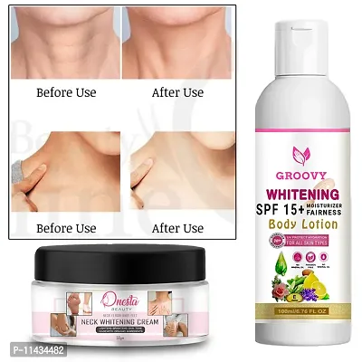 &nbsp;Skin Brightening Cream For Face  Body Whitening Cream Dark Spot Remover 100Gm With Whitening Cream-thumb0