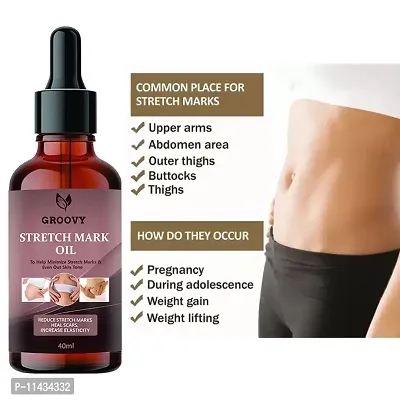 Stretch Marks Oil  Stretch Marks Oil To Reduce Stretch Marks Of Body, Belly, Thighs, Nourishment For Woman  40  ml-thumb2