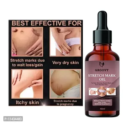 Stretch Marks Oil  Stretch Mark Oil With The Goodness Of Sea buckthorn Oil, Vitamin E And C, Lavender  All Skin Types  For Scars And Stretch Marks-40 ml-thumb0