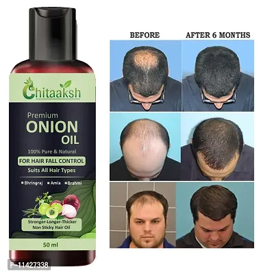 Onion With Black Seed Oil For Controls Hair Fall Hair Oil 50 Ml  For Men And Women-thumb0