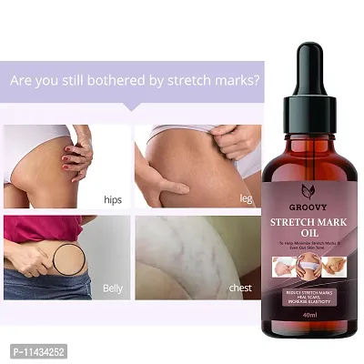 Stretch Marks Oil After Delivery Stretch Mark Removal Oil- 40 ml-thumb0