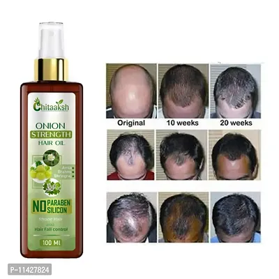 Chitaaksh Onion Hair Oil Hair Regrowth Oil Controls Hair Fall And Dandruff For Men And Women - All Natural Blend Of Coconut, Almond, Curry Leaves Oil And More 100 Ml-thumb0