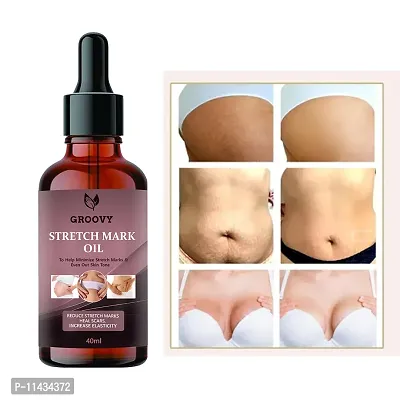 Stretch Marks Oil  Present Stretch Marks Removal Oil - Natural Heal Pregnancy, , Legs, Mark Oil - 40 ml-thumb0