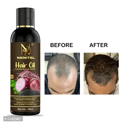 Hair Oil Natural Hair Oil 50 Ml For Men And Women-thumb0