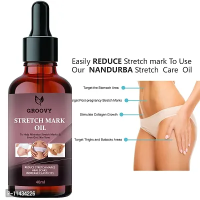 Stretch Marks Oil To Reduce Stretch Marks Of Body, Belly, Thighs, Nourishment For Woman  40  ml