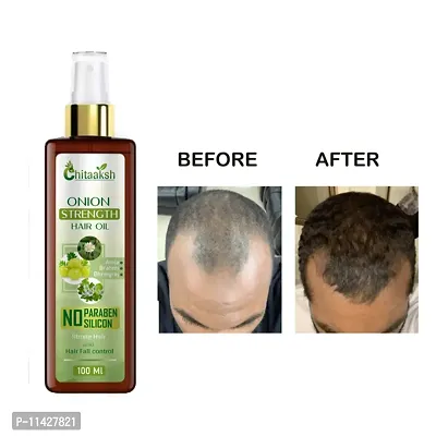 Chitaaksh Onion Oil For Hair Regrowth And Hair Fall Control Hair Oil -100 Ml-thumb0