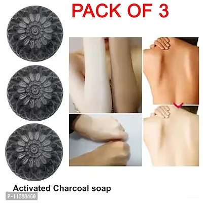 Activated Charcoal Soap For Face And Body Wash- 100 Grams Each, Pack Of 3-thumb0