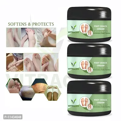 Foot Cream   Hand And Foot Cream And  For Whitening  Suitable For All Skin Type  For Men And Women- Pack Of 3, 50 Grams each