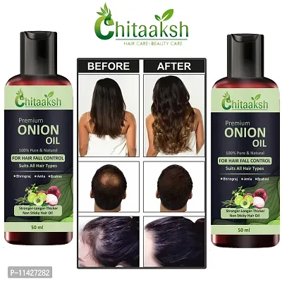 Onion Herbal Hair Oil -For Men And Women Pack Of 2-thumb0