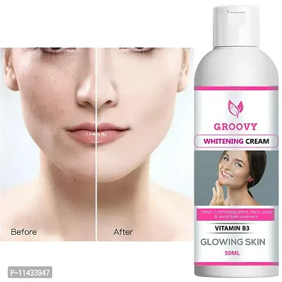 Skin Brightening Cream For Face Body Whitening Cream Dark Spot Remover- 50 Ml-thumb0