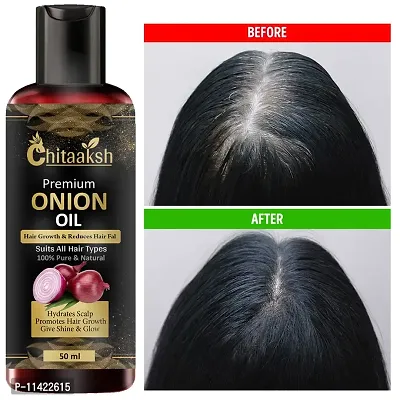 Hair Oil Black Seed Hair Oil For Hair Regrowth And Hair Fall Control Hair Oil 50 Ml-thumb0