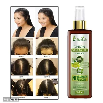 Chitaaksh Onion Hair Oil - 100 Ml-thumb0