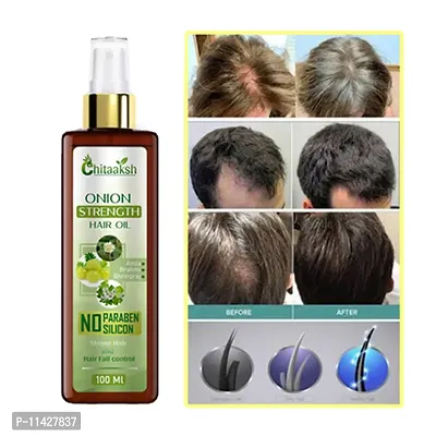 Chitaaksh Onion Hair Oil With Black Seed Oil Extracts - Controls Hair Fall 100 Ml Hair Oil- 100 Ml-thumb0