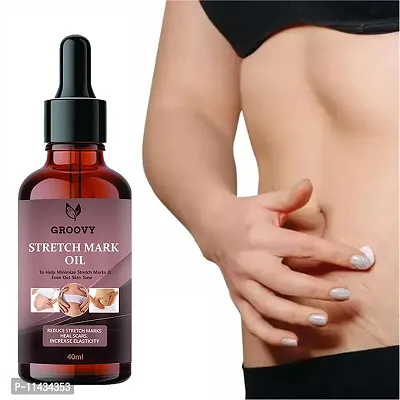 Stretch Marks Oil To Minimize Stretch Marks And Even Out Skin Tone- 40 ml-thumb0