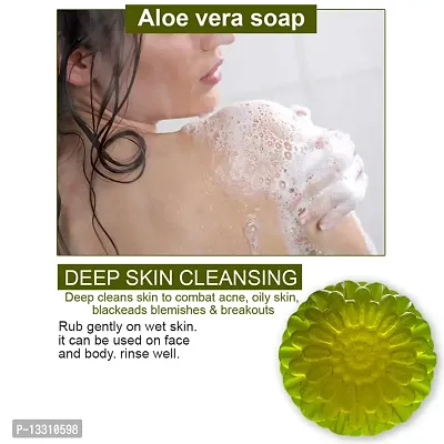 Healing Aloe Vera Soap With Antioxidant-Rich Ingredients For Skin Repair -100 Grams-thumb0