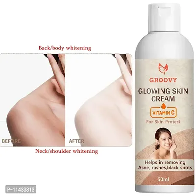 Skin Whitening Lotion Cream Look As Young As U Feel -Acne Care Face Cream, Face Cream - 50 Ml-thumb0