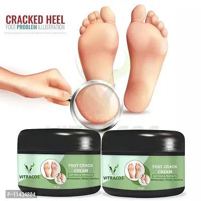 Foot Bath Soothing Cracked Heels Repair Cream With  Aromatherapy Spa Pedicure Gelatinous Mixture- Pack Of 2, 50 Grams each