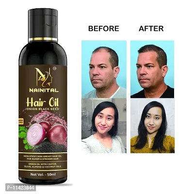 Hair Oil Help For Rapid Hair Growth,Anti Hair Fall, Split Hair And Promotes ,Pack Of 1 For Men And Women-thumb0