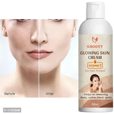 Skin Brightening Cream For Face Body Whitening Cream Dark Spot Remover- 50 Ml