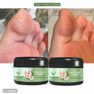 Ayurvedic Cream , For Healing And Soothing Of Heels Krack Crack Foot Care- Pack Of 2, 50 Grams each