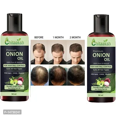 Ayurvedic Onion with black seed Oil for Controls Hair Fall Hair Oil 50ml (pack of 1) PACK OF 2-thumb0