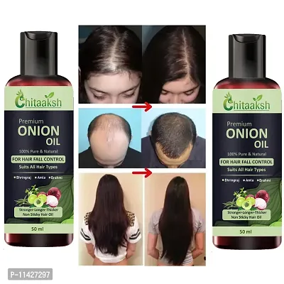 Onion Black Seed 50 Ml Hair Oil Pack Pack Of 2-thumb0