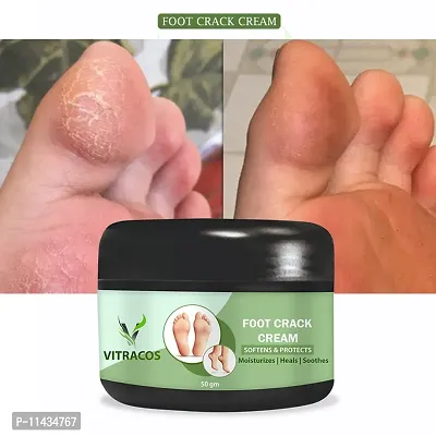 Foot Crack Cream  Paraben Free- 50 Grams-thumb0